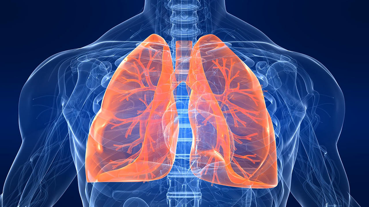 tumore al polmone ALK+