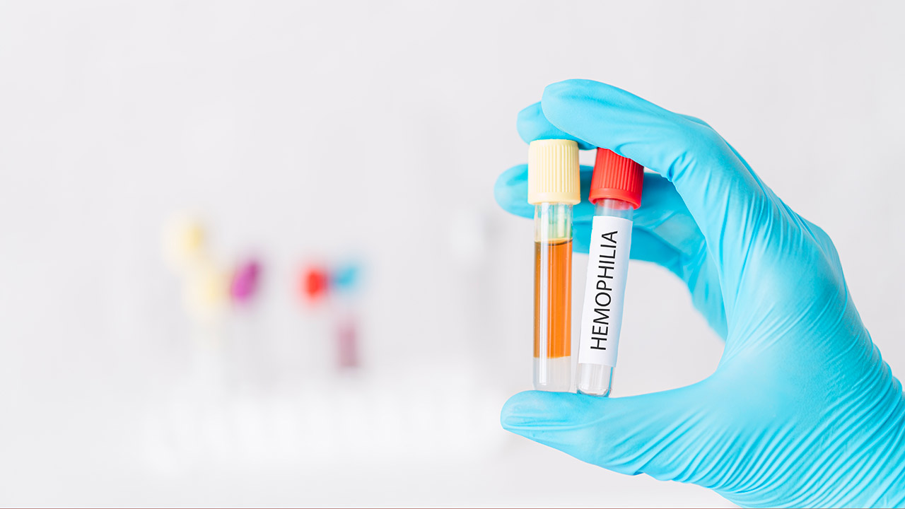 rimborsabilità terapia genica