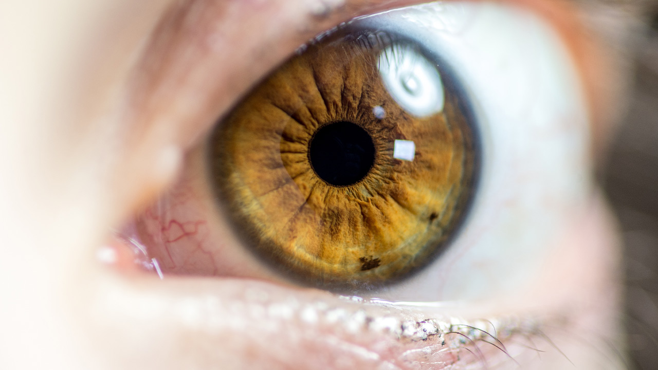 Malattie della retina