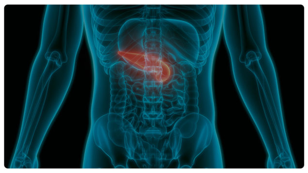 tumori neuroendocrini