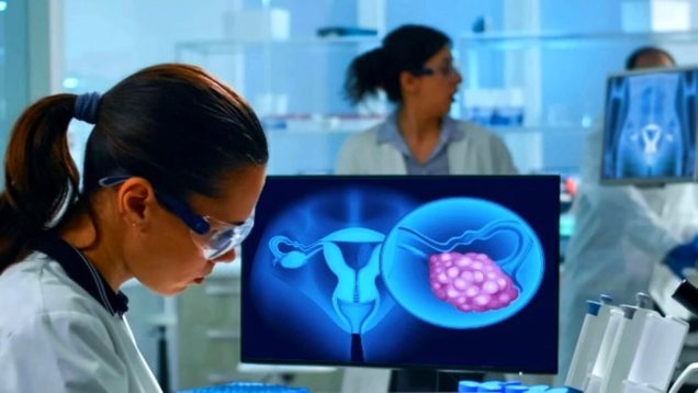 tumore cervice uterina